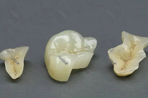 补牙部分实物.jpg