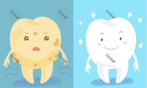 牙齿美白前后对比图.png