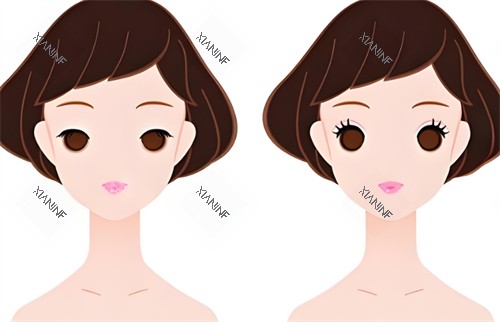 双眼皮前后对比图.jpg