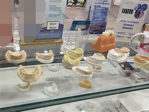 湘潭贝壳口腔牙齿模型展示.jpg