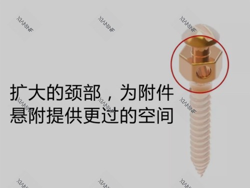 正畸支抗钉细节图.jpg