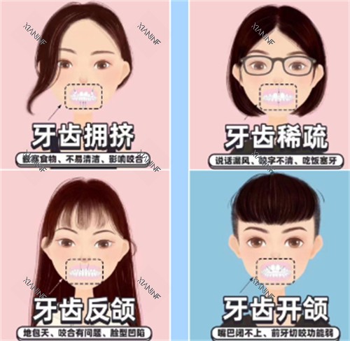 牙齿矫正自查表.jpg