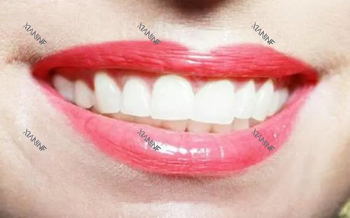 标准门牙图片.webp.jpg