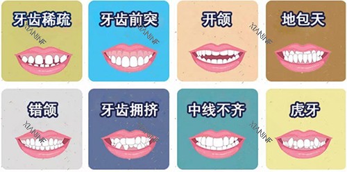 牙齿矫正不同适应症漫画图.jpg