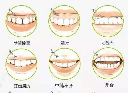 牙齿矫正不同的适应症.jpg