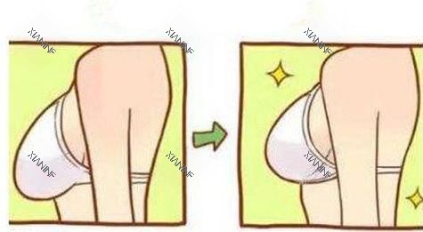 乳房提升手术.jpg