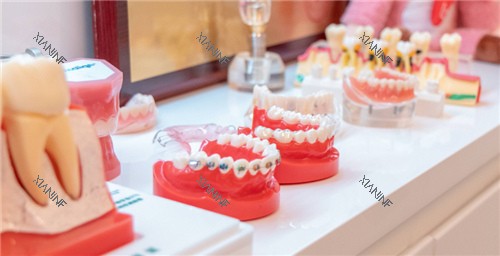 牙套牙模展示.jpg